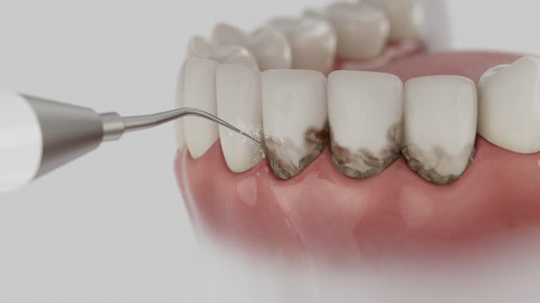 Reliable Dental contractor in La Presa, CA by Dentist Open Now